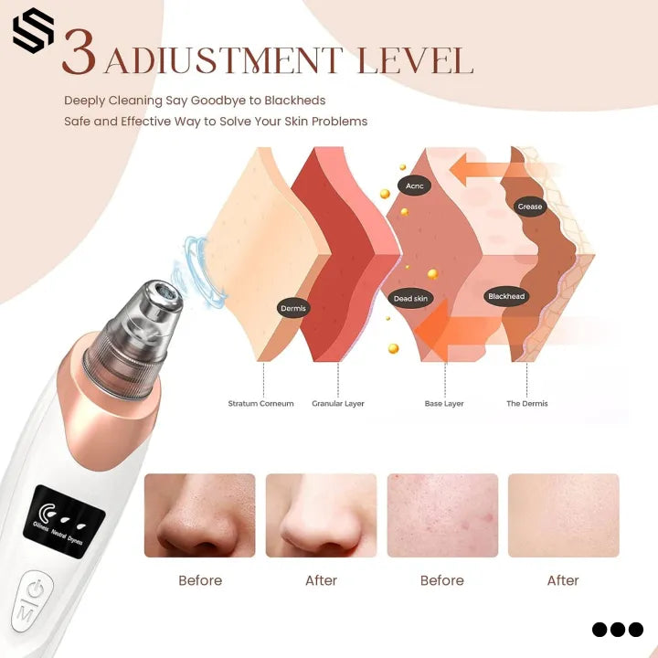 5 In 1 Black Head Remover Machine