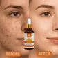 Relax Vitamin C Daily Face Serum – Brightening