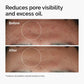 The Ordinary Niacinamide 10% + Zinc 1% Serum